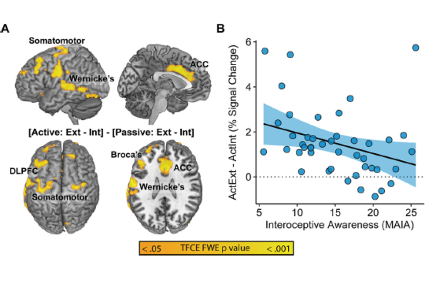 Neuroimaging: Interoception